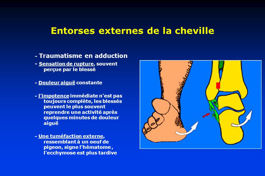 Traumatologie de la cheville ppt video online t l charger